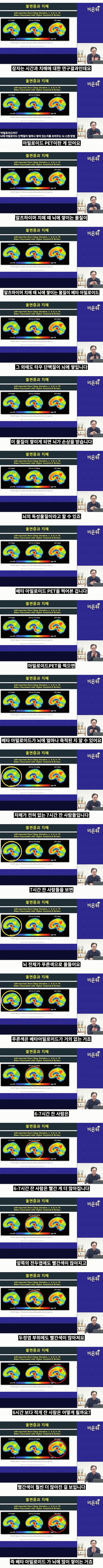 7시간 이상 수면이 필요한 이유 ㄷㄷ