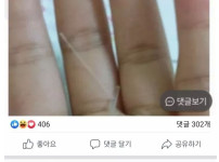 똥꼬가 따가워서 봤더니