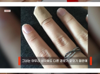 네일샵 갔다가 성병걸림 ㄷㄷㄷ