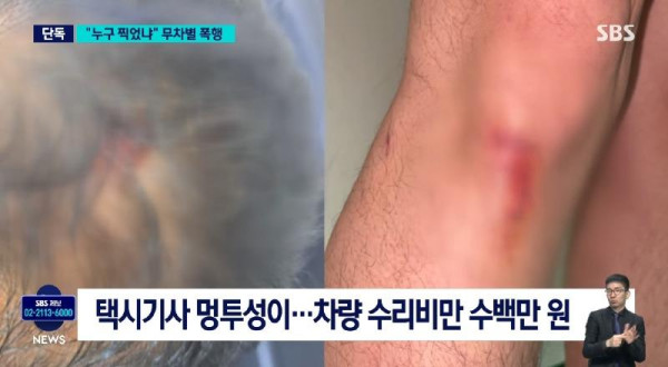 택시기사 무차별 폭행한 20대 남성