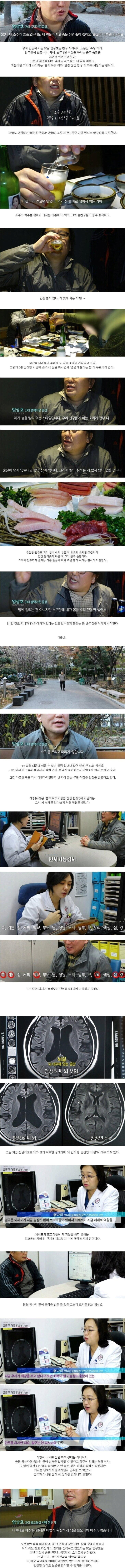 50대 애주가의 뇌상태