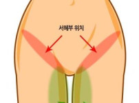 두산 양의지 부상 서혜부 위치
