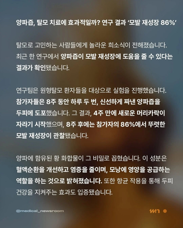 양파즙의 효능 탈모에 탁월