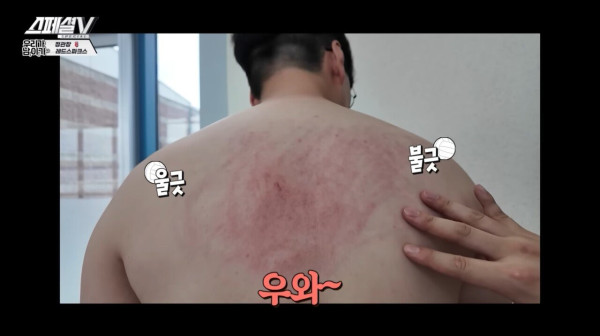 여자배구선수에게 등짝 스매시를 맞으면?