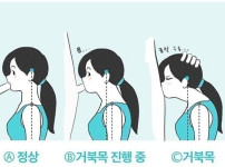 거북목 진단법 ㄷㄷㄷㄷㄷㄷ