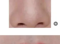 눈,코,입이 예뻐도 안 예쁠 수 있음
