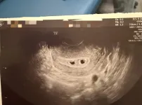 나 애국자맞지? 쌍둥이 치트!!!