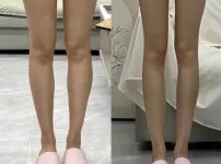남자는 왼쪽 여자는 오른쪽 선택한다는 다리모양