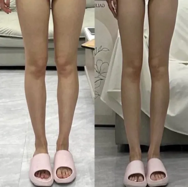 남자는 왼쪽 여자는 오른쪽 선택한다는 다리모양