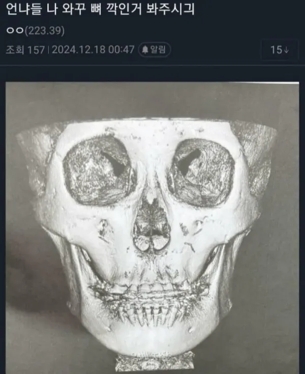 뼈를 깎는 노력을 한 언냐