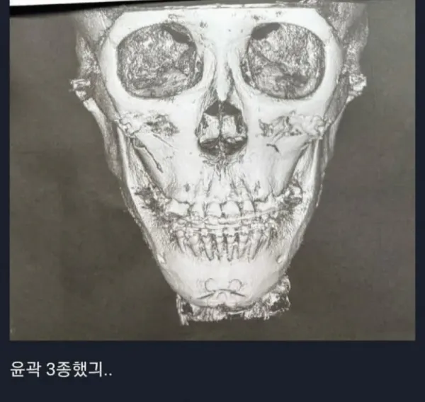 뼈를 깎는 노력을 한 언냐