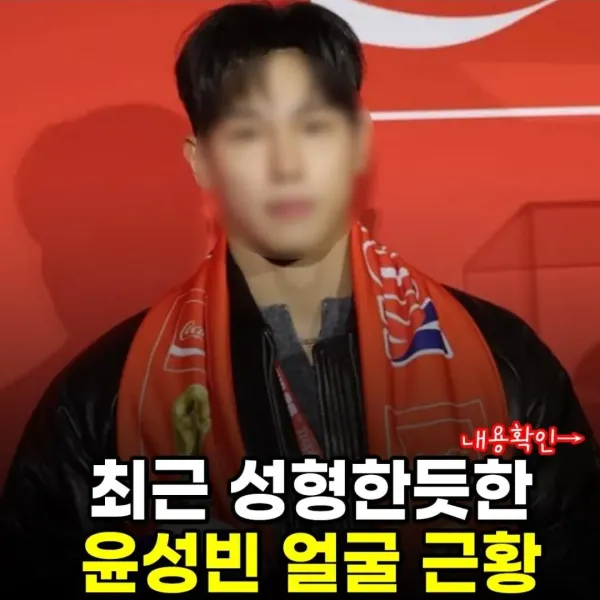 최근 성형한 윤성빈 근황.jpg