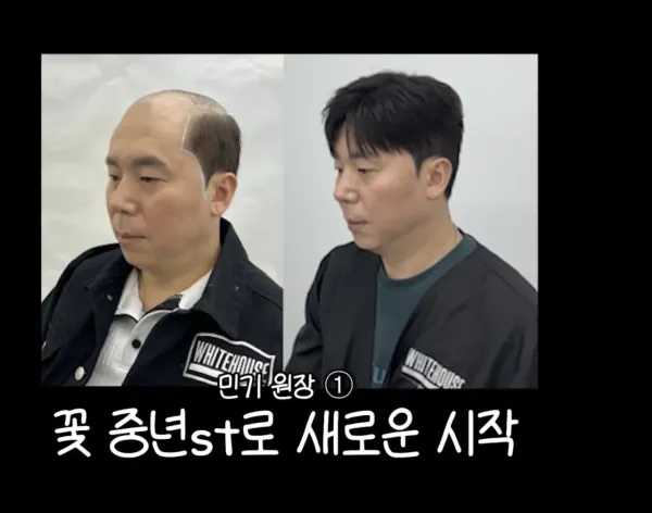 남자 머리의 중요성