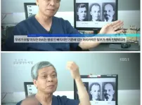 M자 탈모의 위험성