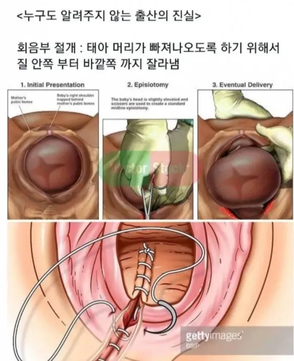 카디비도 몰랐던 여자가 출산할때 겪는일