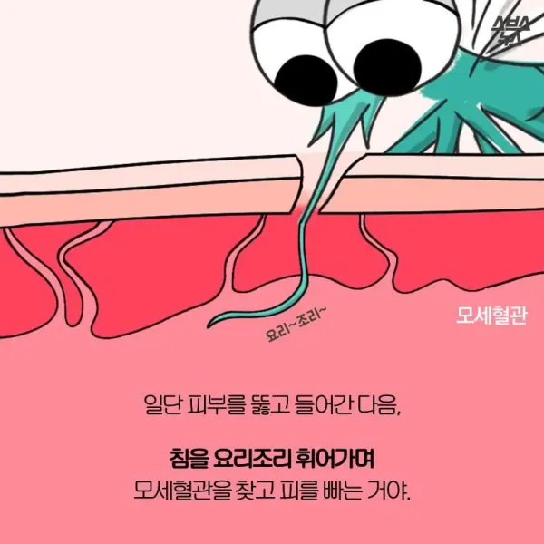 모기가 물면 가려운 이유