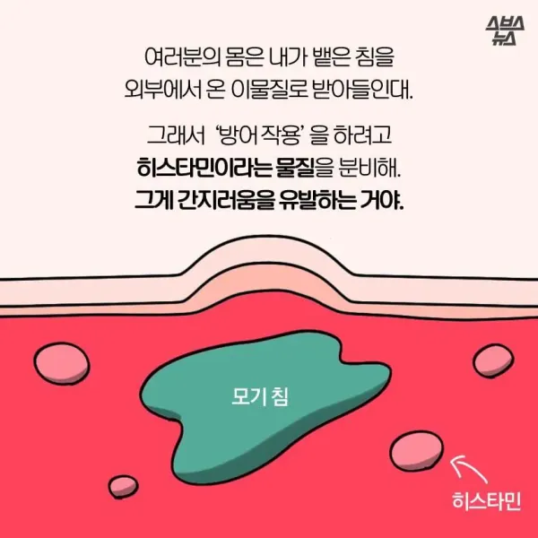 모기가 물면 가려운 이유