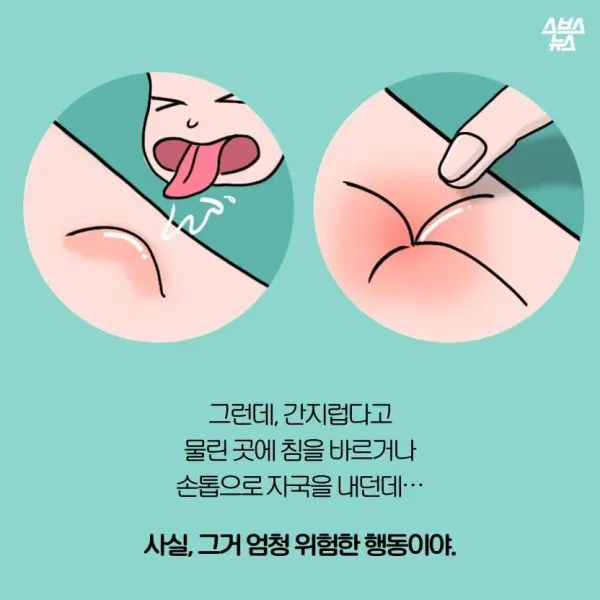모기가 물면 가려운 이유