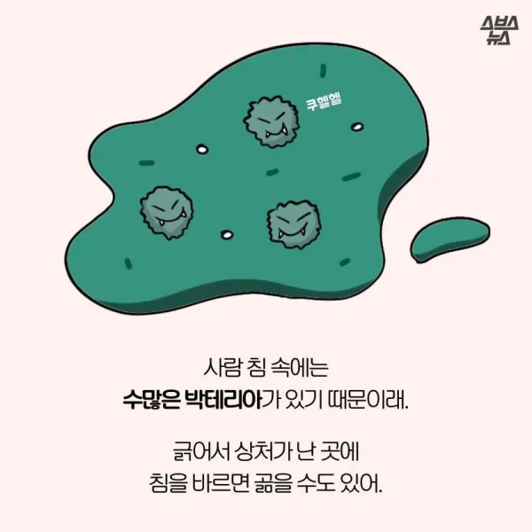 모기가 물면 가려운 이유