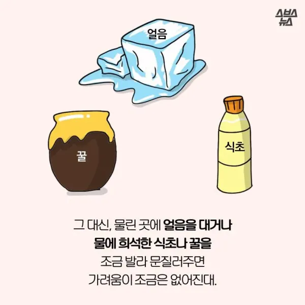 모기가 물면 가려운 이유