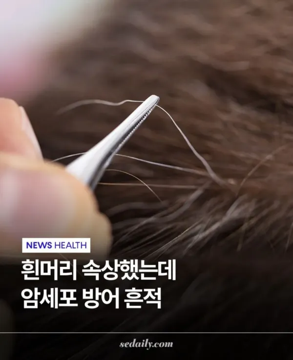 도쿄대에서 밝혀낸 흰머리의 비밀