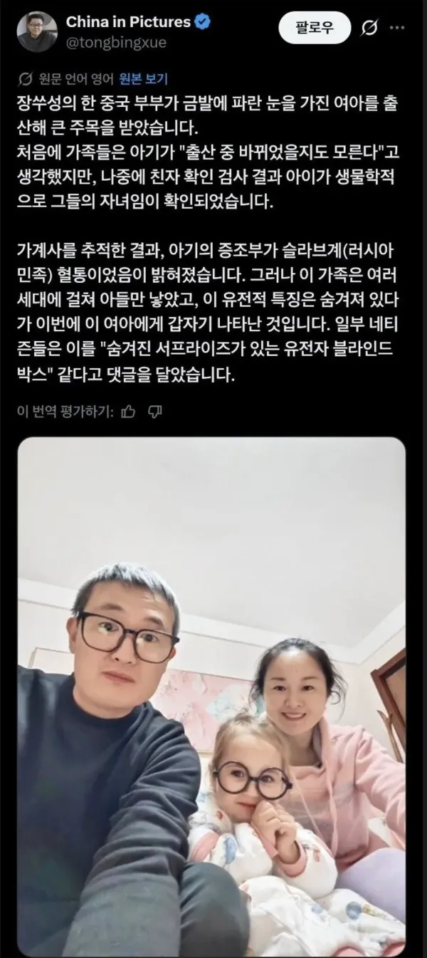 백인 아이를 출산한 중국인 부부