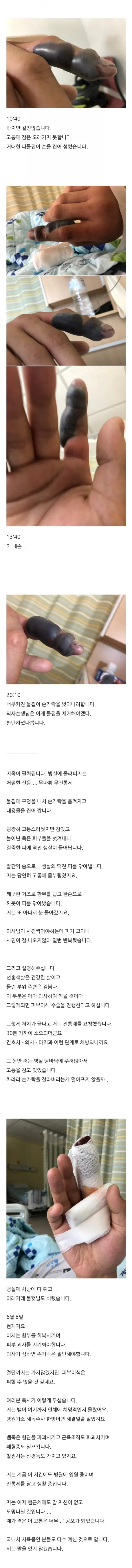 혐주의) 쇠살모사에 물린 손가락