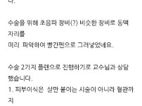 혐주의) 쇠살모사에 물린 손가락