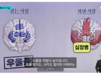 참는사람 vs 화낸사람 의 뇌 상태