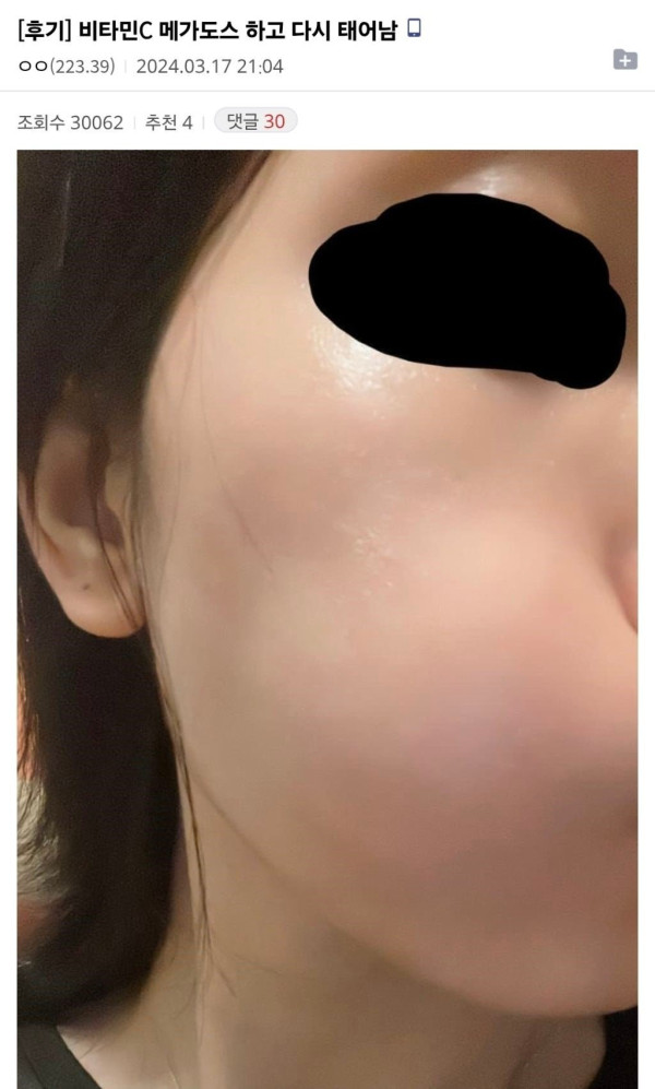비타민C 메가도스 하고 다시 태어남.jpg