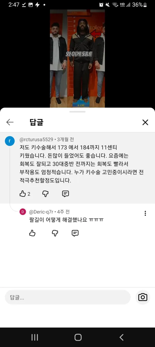 키수술 부작용 없다는 댓글