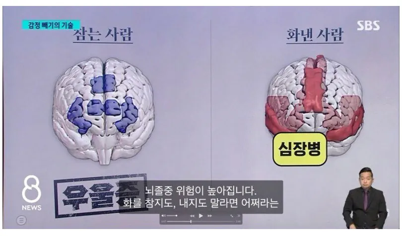 화를 참는 사람 뇌 vs 화를 내는 사람 뇌