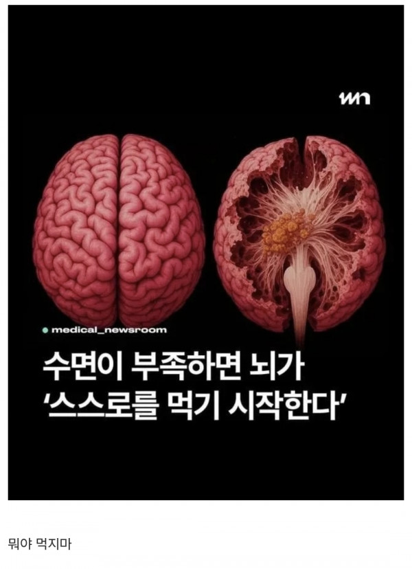먹지마 ㅠ