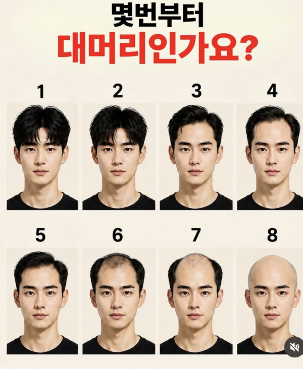 몇번부터 대머리인가요?