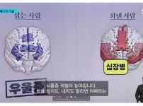 화를 참는 사람 뇌 vs 화를 내는 사람 뇌